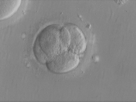 Wat is nu eigenlijk precies de maximale leeftijd voor een IVF- behandeling?